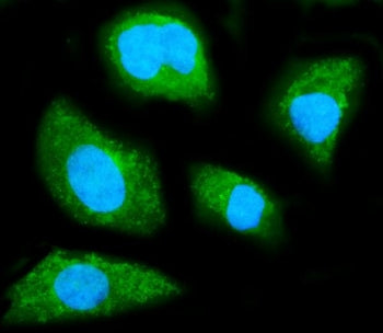 GNB1 Antibody / Guanine nucleotide binding protein beta 1 subunit