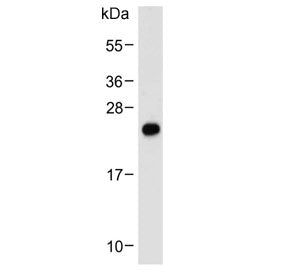 Western blot testing of human placenta lysate with NGN3 antibody. Predicted molecular weight ~23 kDa