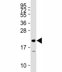 MLL2 Antibody