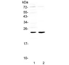 Il-6 Antibody