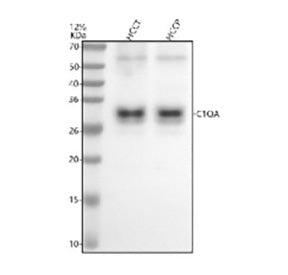 Western blot analysis of C1QA using anti-C1QA antibody. Electrophoresis was performed on a 12% SDS-P