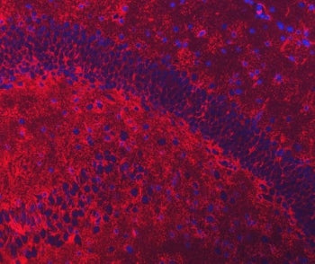 EAAT2 Antibody
