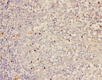 FOXP3 Antibody