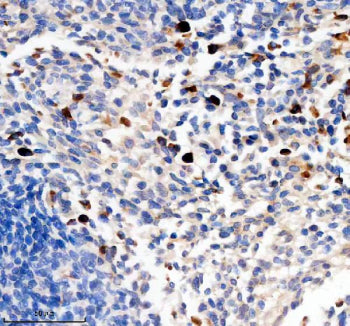 Immunohistochemical staining of TCIRG1 using anti-TCIRG1 antibody. TCIRG1 was detected in a paraffin