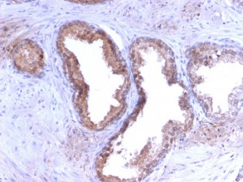 PSA / Prostate Specific Antigen Antibody