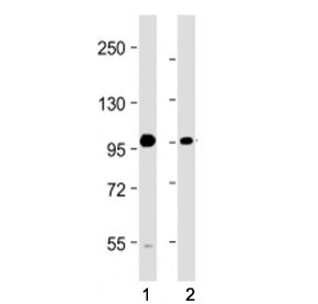Western blot testing of BMP1 antibody at 1:2000: Lane 1) human A549 and 2) U-251 MG cell lysate. Pre