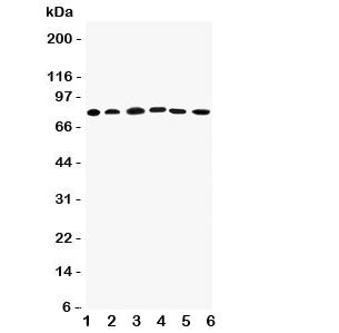 Proprotein Convertase 1/3 Antibody