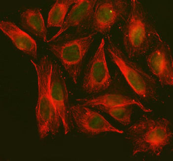 Immunofluorescent staining of NOL9 using anti-NOL9 antibody (green) and anti-Beta Tubulin antibody (