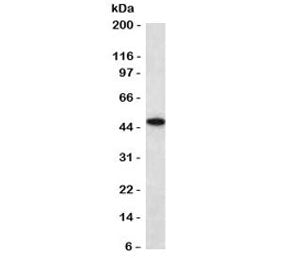 Western blot testing of human HCT116 antibody with recombinant Keratin 18 antibody (clone CTKN18-2R)