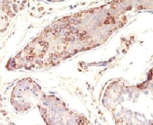 MAGE-1 Antibody