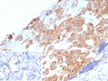 IHC staining of FFPE human placental tissue with MHC class I antigen G antibody (clone HLAG/7749). I