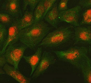 Immunofluorescent staining of FFPE human A549 cells with SMC2 antibody (red) and Beta Tubulin mAb (g