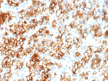 CA9 Antibody / Carbonic Anhydrase IX