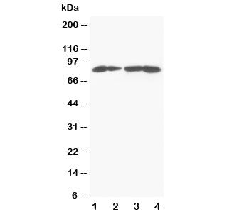 Western blot testing of MTA1 antibody and Lane 1: MCF-7; 2: HeLa; 3: Jurkat; 4: CEM cell lysate. Pre