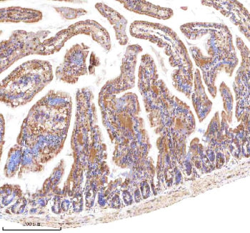 Immunohistochemical staining of LGR5 using anti-LGR5 antibody. LGR5 was detected in a paraffin-embed