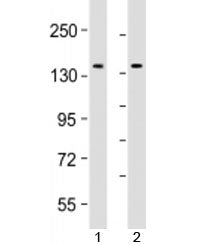 TACC3 Antibody