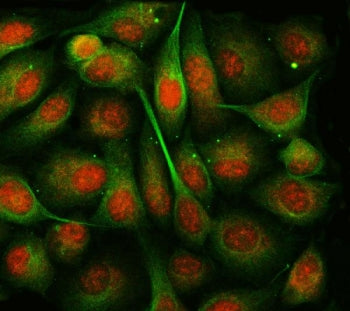 Immunofluorescent staining of FFPE human PC-3 cells with TSEN54 antibody (red) and Beta Tubulin mAb