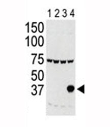 Western blot testing of Aurora-C antibody and lysate of 293 cells expressing 1) Flag tag, 2) Flag-ta