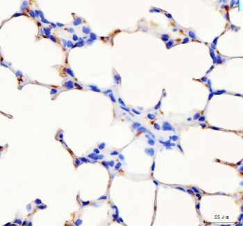 PF4 Antibody / Platelet factor 4