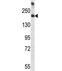 A2M antibody western blot analysis in human placenta tissue lysate. Predicted molecular weight: ~163