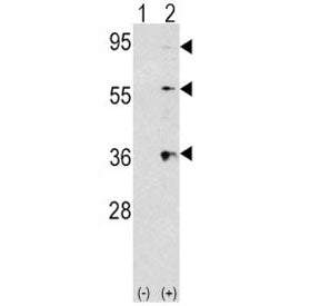 Thrombopoietin Antibody (THPO)