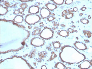 DBC2 Antibody / RHOBTB2