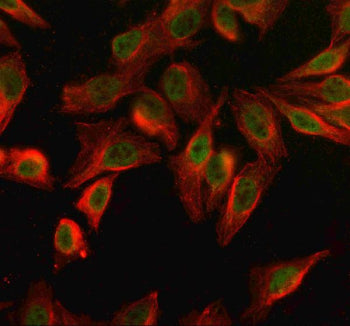 Immunofluorescent staining of SPO11 using anti-SPO11 antibody (green) and anti-Beta Tubulin antibody
