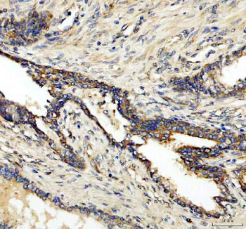 IHC analysis of CLCN3 using anti-CLCN3 antibody. CLCN3 was detected in a paraffin-embedded section o