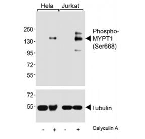 Phospho-MYPT1 Antibody (Ser668)