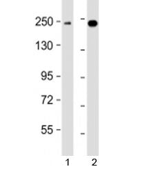 Western blot testing of human 1) K562 and 2) MCF7 cell lysate with XRN1 antibody at 1:2000. Predicte