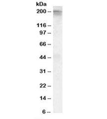 Western blot testing of human heart lysate with CACNA1C antibody at 0.5ug/ml. Predicted molecular we