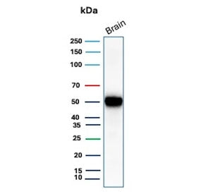 GFAP Antibody / Glial Fibrillary Acidic Protein