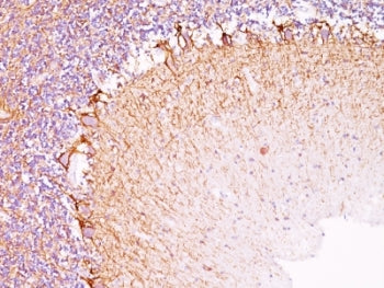 Neurofilament Antibody (-Light) / NF-L / NEFL