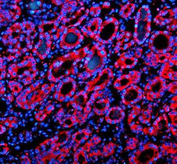 Immunofluorescent staining of SIL1 using anti-SIL1 antibody (red). SIL1 was detected in a paraffin-e