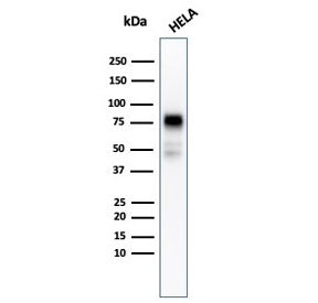 Western blot testing of human HeLa cell lysate with recombinant CD44 antibody (clone rHCAM/918). Pre
