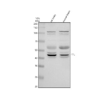 Western blot analysis of TTL using anti-TTL antibody. Electrophoresis was performed on a 10% SDS-PAG