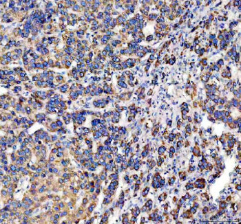 Western blot testing of DCI antibody and Lane 1: rat liver; 2: human placenta; 3: A549; 4: SMMC-7721