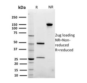 SDS-PAGE analysis of purified, BSA-free ARF1 antibody (clone 3F1) as confirmation of integrity and p