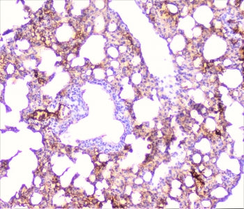 TNF Receptor I Antibody / TNFR1 / TNFRSF1A