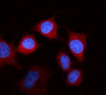 Immunofluorescent staining of FFPE human A549 cells with Fibrinogen beta chain antibody (red) and DA