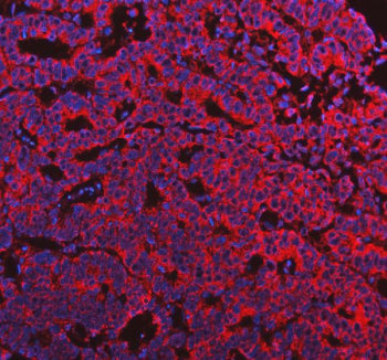 Immunofluorescent staining of FFPE human stomach tissue with AqCbl reductase antibody (red) and DAPI nuclear stain (blue). HIER: steam section in pH8 EDTA buffer for 20 min.