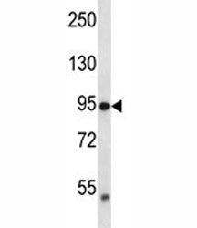 TRPV2 antibody western blot analysis in MDA-MB435 lysate. Expected molecular weight: 85-95 kDa depen