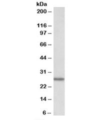 Western blot testing of human peripheral lymphocytes lysate with LAT2 antibody at 0.01ug/ml. Predict
