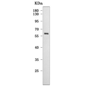 Western blot testing of human HeLa cell lysate with CYP27B1 antibody. Predicted molecular weight ~57