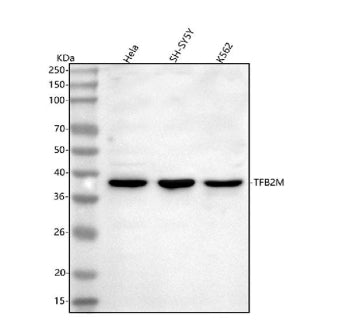 Western blot analysis of TFB2M using anti-TFB2M antibody. Lane 1: human Hela whole cell lysates, Lan