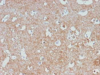 IHC staining of human cerebellum with recombinant Neurofilament antibody (clone NEFL/2983R). HIER: b