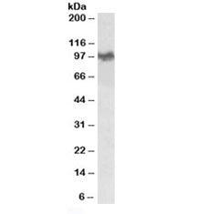 Western blot testing of mouse brain lysate with Abeta antibody at 0.03ug/ml. Predicted molecular weight 79~120kDa depending on glycosylation level.
