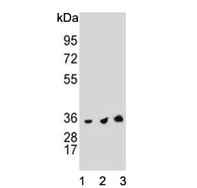 Western blot testing of human 1) HeLa, 2) Jurkat and 3) HL60 cell lysate with Thymidylate Synthase a