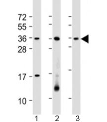 RSPO1 Antibody / R-spondin-1