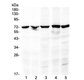 Western blot testing of 1) rat kidney, 2) mouse kidney, 3) human MCF7, 4) human 22RV1 and 5) human H
